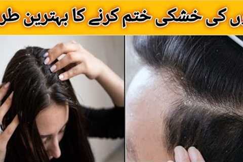 dandruff removal| dandruff treatment at home| hair loss