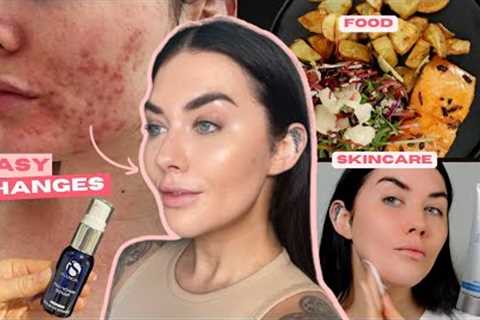 Complete Guide to Achieving Flawless Skin: Diet, Skincare Routine & Treatments