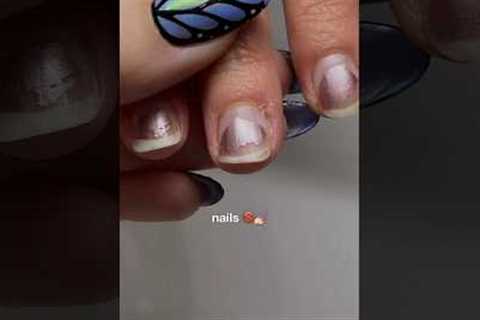 this nail transformation 💯😮‍💨 💅🏻✨ #nails #nailsathome #beforeandafter #transformation #nailart